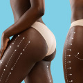 Post-Operative Care Tips for a Successful Brazilian Butt Lift